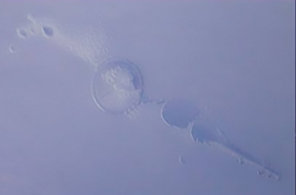 360-1-困气：注塑时带入空气